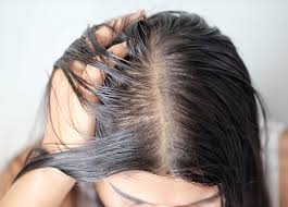 hairs fall causes